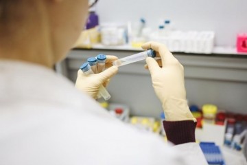 STOŽER: U Hrvatskoj 9.924 nova slučaja zaraze virusom, preminulo 65 osoba