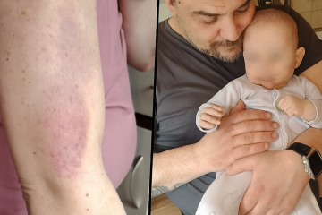 Borba s 20 dijagnoza, plućnom embolijom i glađu – obitelj Ujdur traži ruku spasa