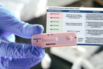 Mislite da ste 'prehodali' koronu i htjeli biste se testirati? Otkrivamo sve o serološkim testovima, gdje se mogu obaviti i koliko koštaju